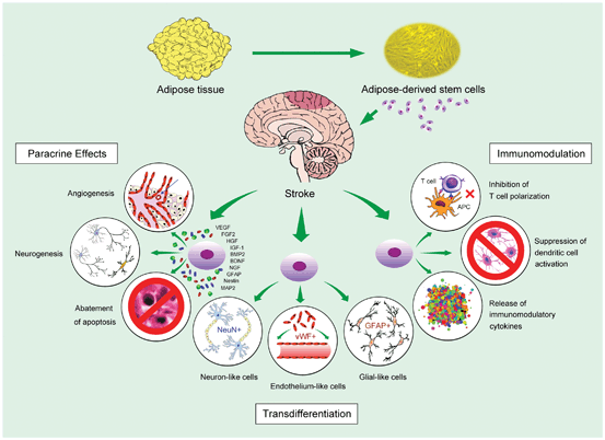 Transplantation of AdiposeDerived Stem Cells in Stroke