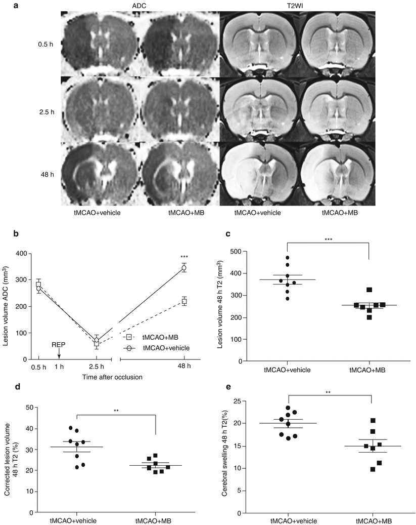 Blue Ameliorates Ischemia/Reperfusion-Induced Cerebral Edema: An MRI ...