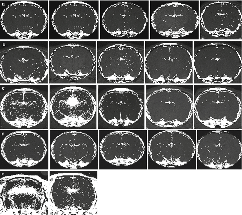 And Inflammation-Induced Disruptions Of The Blood-Brain And Blood ...