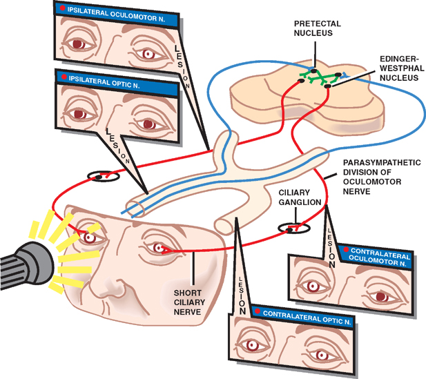 cranial nerve test pupil constriction