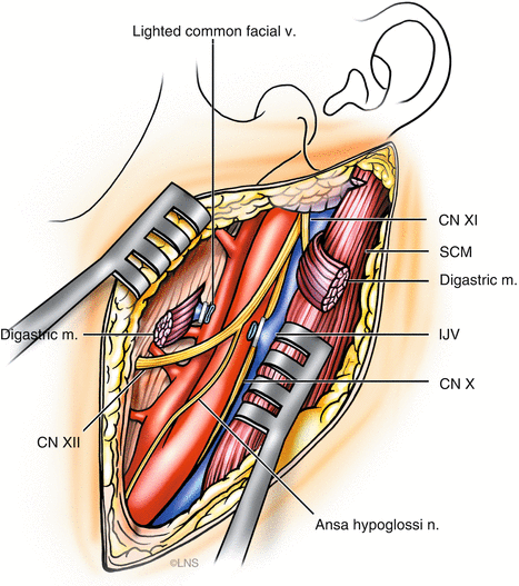 A141673_2_En_40_Fig6_HTML.gif