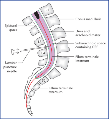 spinal filum terminale cord conus medullaris subarachnoid end space internum externum lower lumbar puncture lumbosacral sagittal fig region section showing