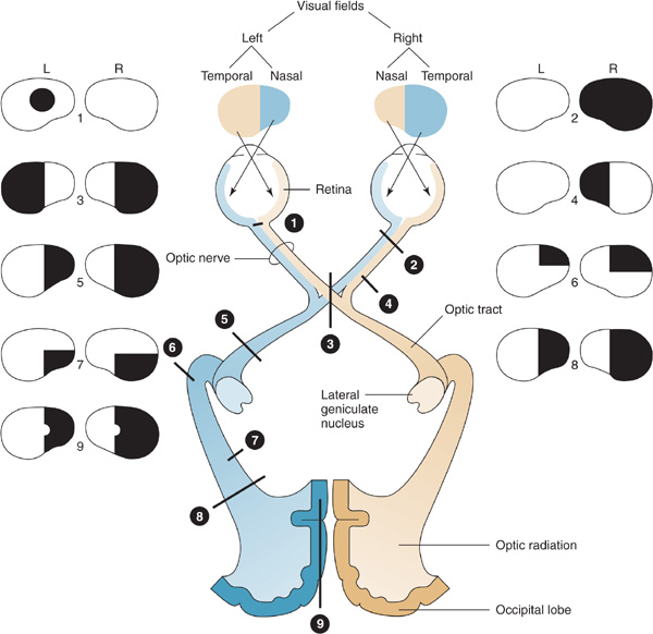 Neuro Ophthalmic Disorders Neupsy Key 