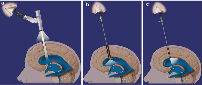 A189107_1_En_6_Fig1_HTML.jpg