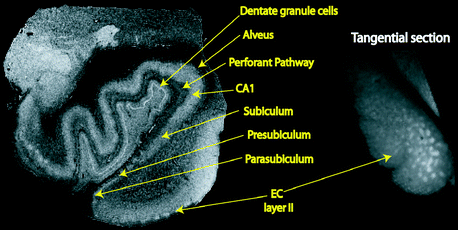 A270652_1_En_4_Fig6_HTML.gif