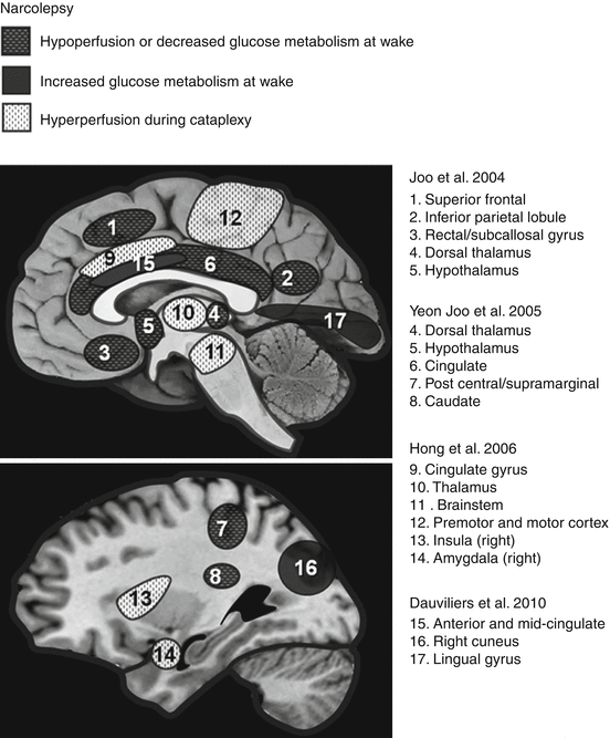 A303920_1_En_34_Fig1_HTML.gif