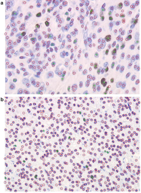 Computer Systems for Cell Counting in Histopathologic Slides of Tumours ...