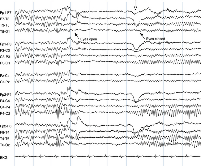 Visual Analysis of the EEG Neupsy Key