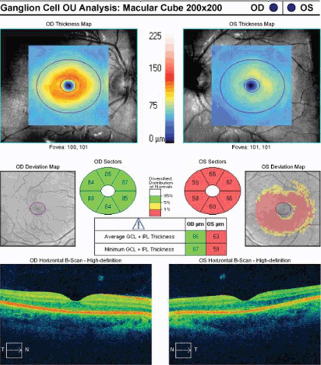 handbook optical coherence tomography