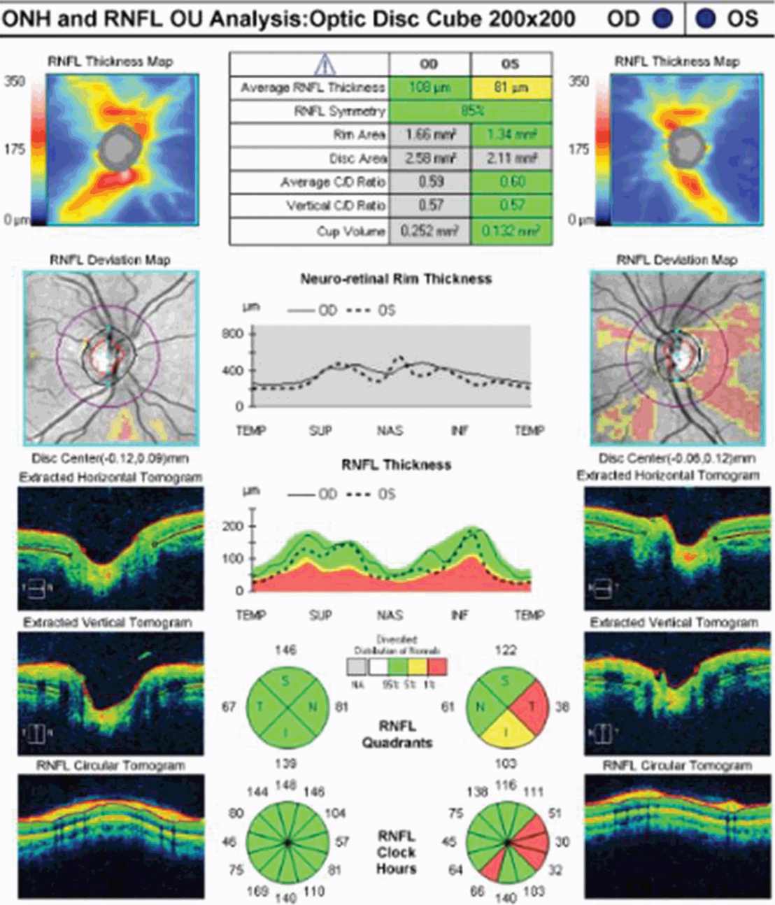 guide to optical coherence tomography interpretation