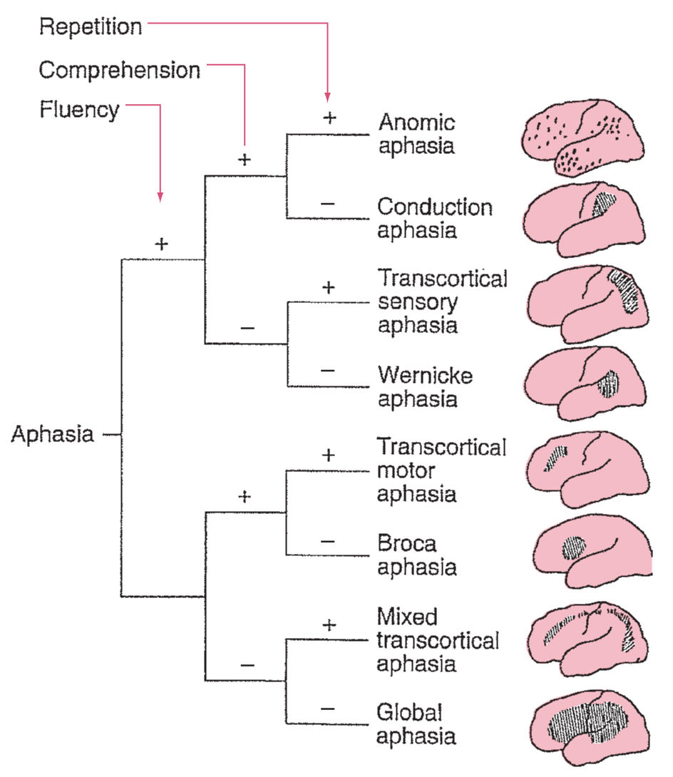 Conduction Aphasia