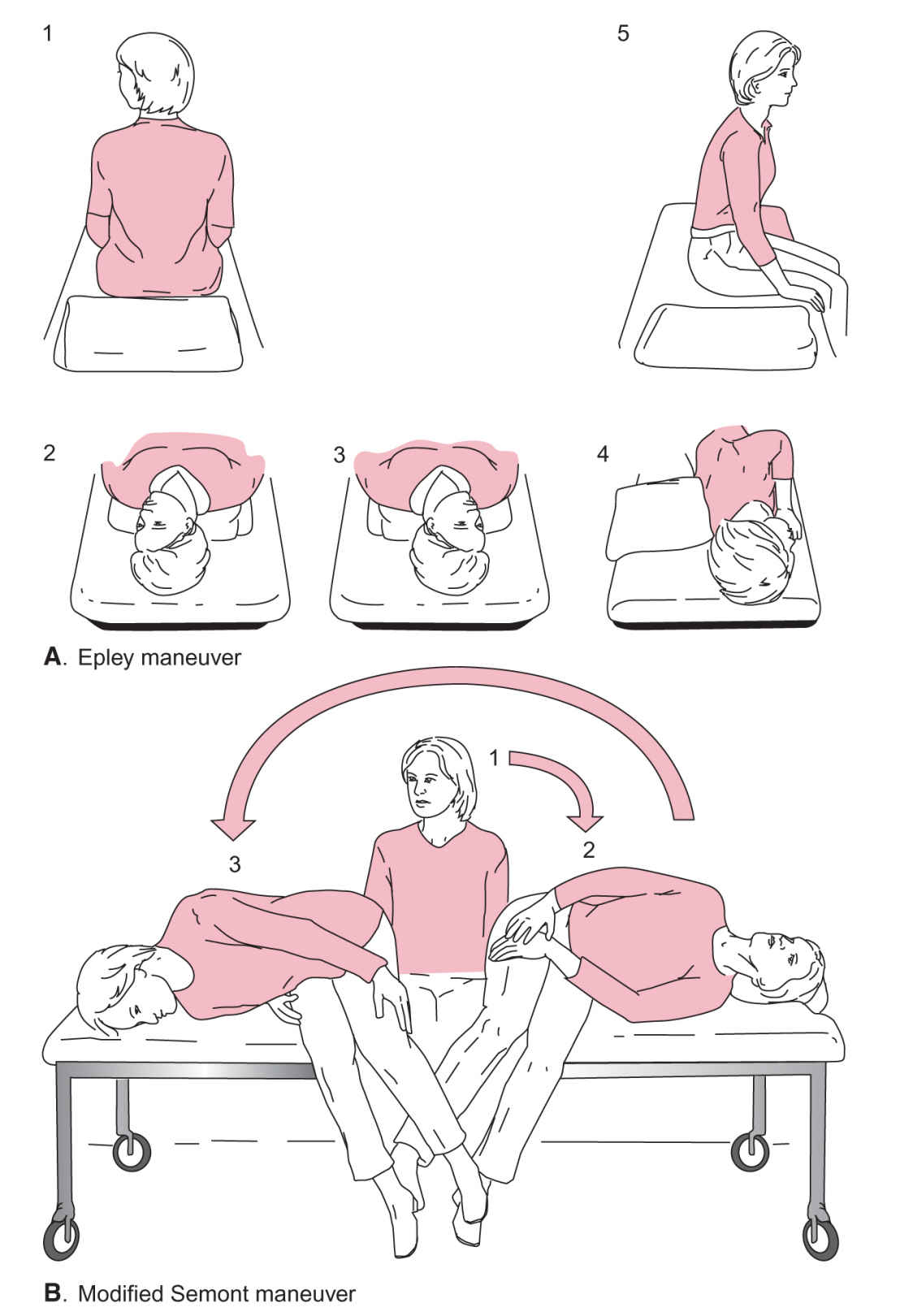 Epley Maneuver for dizziness and vertigo relief