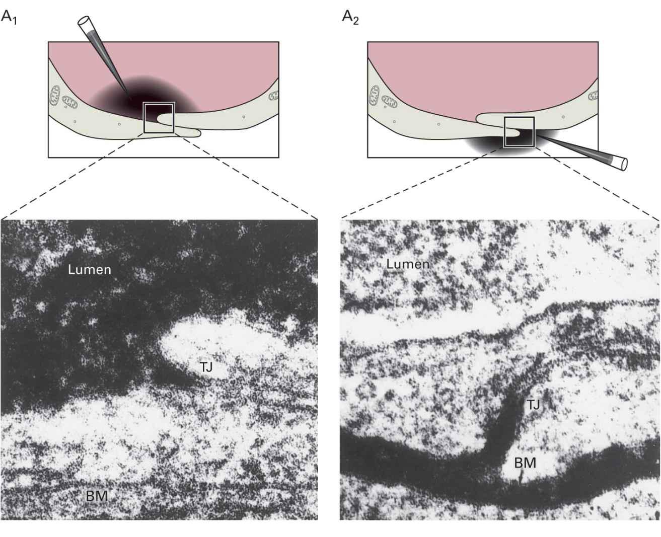 The Blood–Brain Barrier, Choroid Plexus, And Cerebrospinal Fluid ...