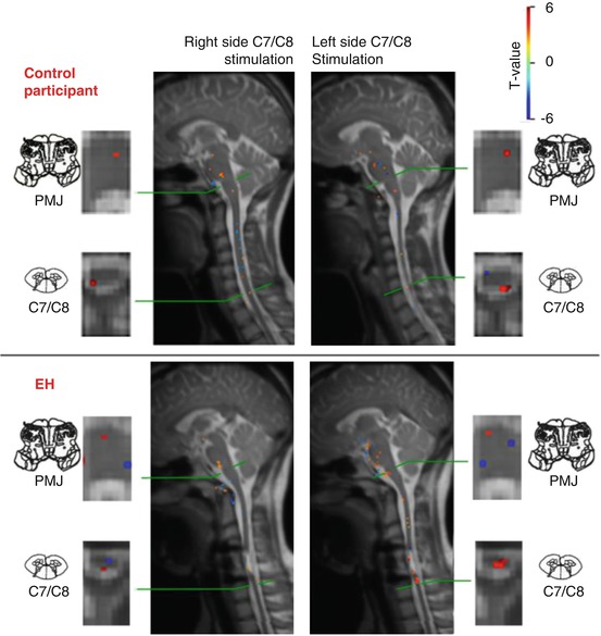 Spinal Cord Imaging | Neupsy Key