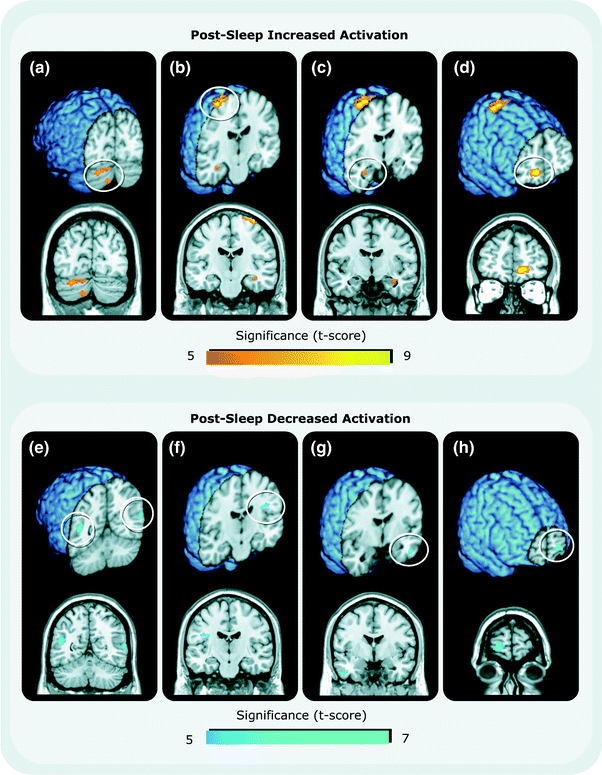 Sleep And Memory Consolidation | Neupsy Key