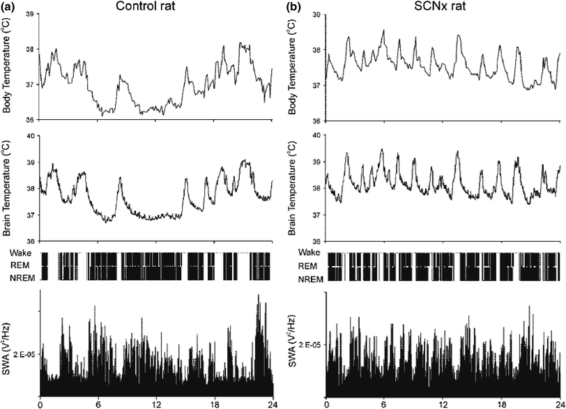 Neurobiology Of NREM Sleep And Thermoregulation In Sleep | Neupsy Key