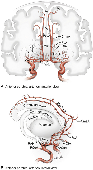 Surgical Management Of Anterior Communicating And Anterior Cerebral ...