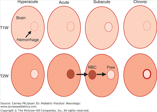 Neuroimaging In The Management Of Neurological Disease | Neupsy Key