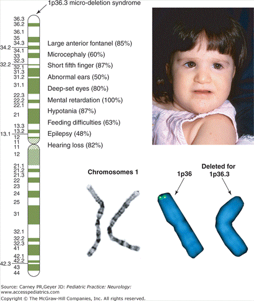 Genetic Testing For Neurological Disorders | Neupsy Key