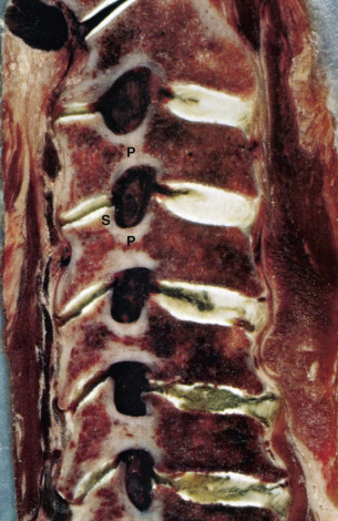 Applied Anatomy Of The Cervical Spine | Neupsy Key