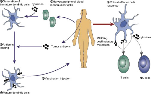 General Principles Of Immunotherapy For Glioblastoma Neupsy Key