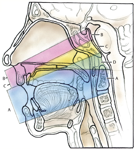 Transoral And Transnasal Approaches To The Craniocervical Junction ...