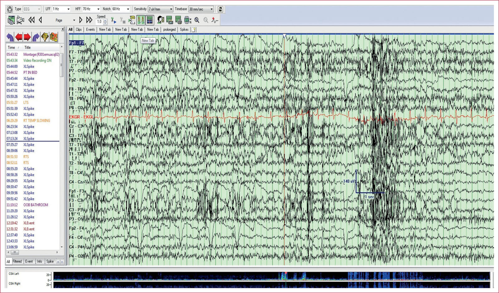 eeg 2011年 f122.jpg