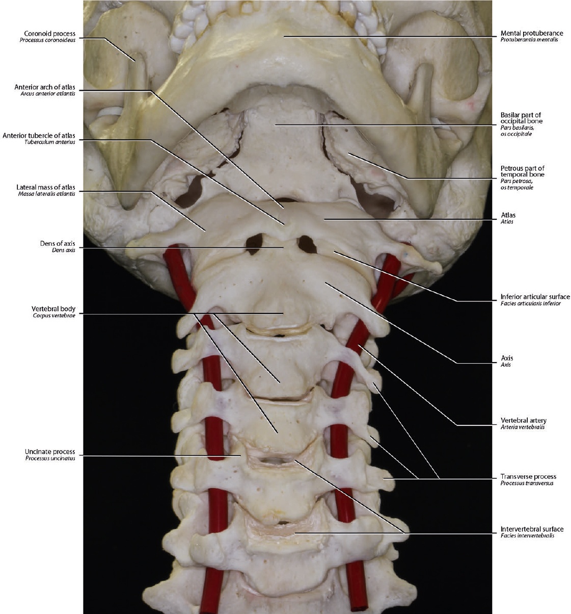 3 Cervical Vertebrae | Neupsy Key