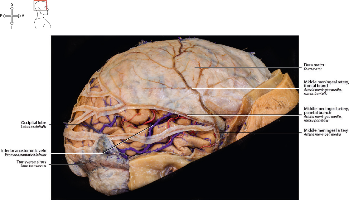 22 Brain, Meninges, And Sutures | Neupsy Key