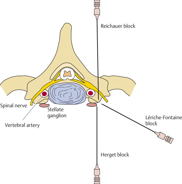 10 General And Specific Complications And Treatment Measures | Neupsy Key