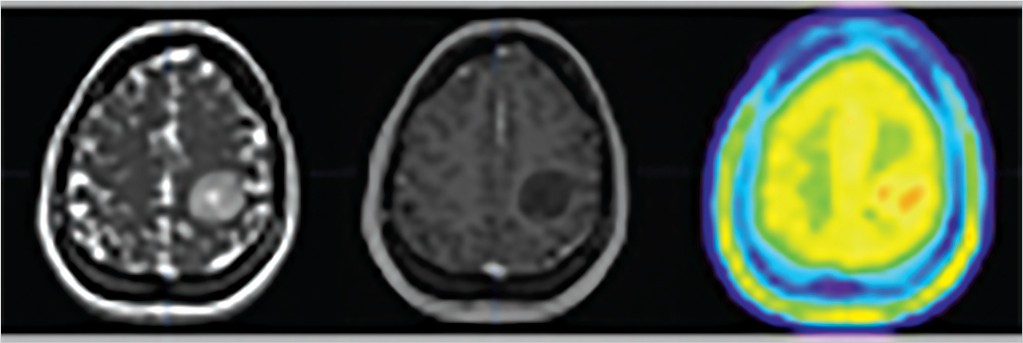 6 Functional Neuroimaging II | Neupsy Key