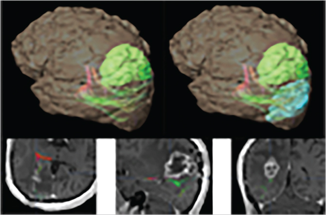 6 Functional Neuroimaging II | Neupsy Key