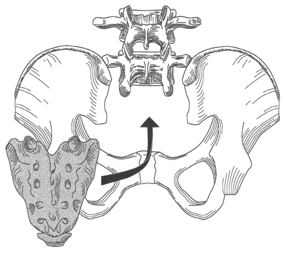 24 Lumbosacral–Pelvic Constructs | Neupsy Key