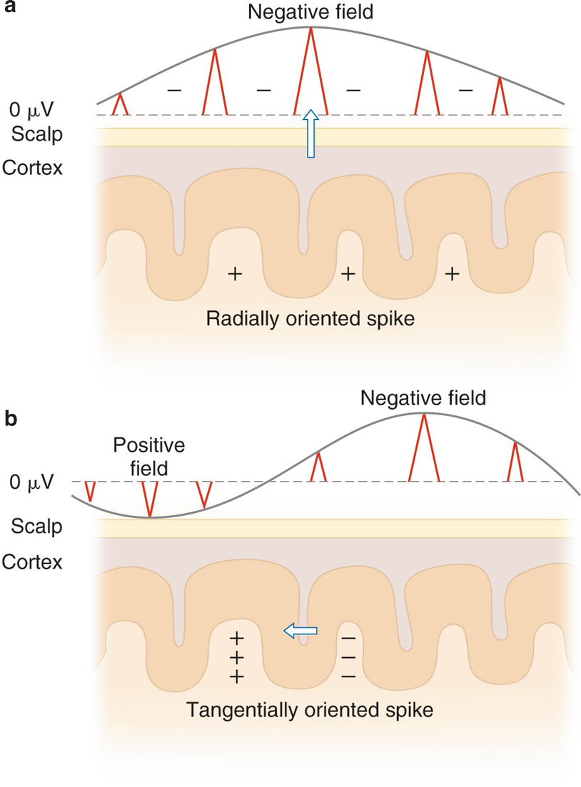 ../images/310119_2_En_10_Chapter/310119_2_En_10_Fig5_HTML.png