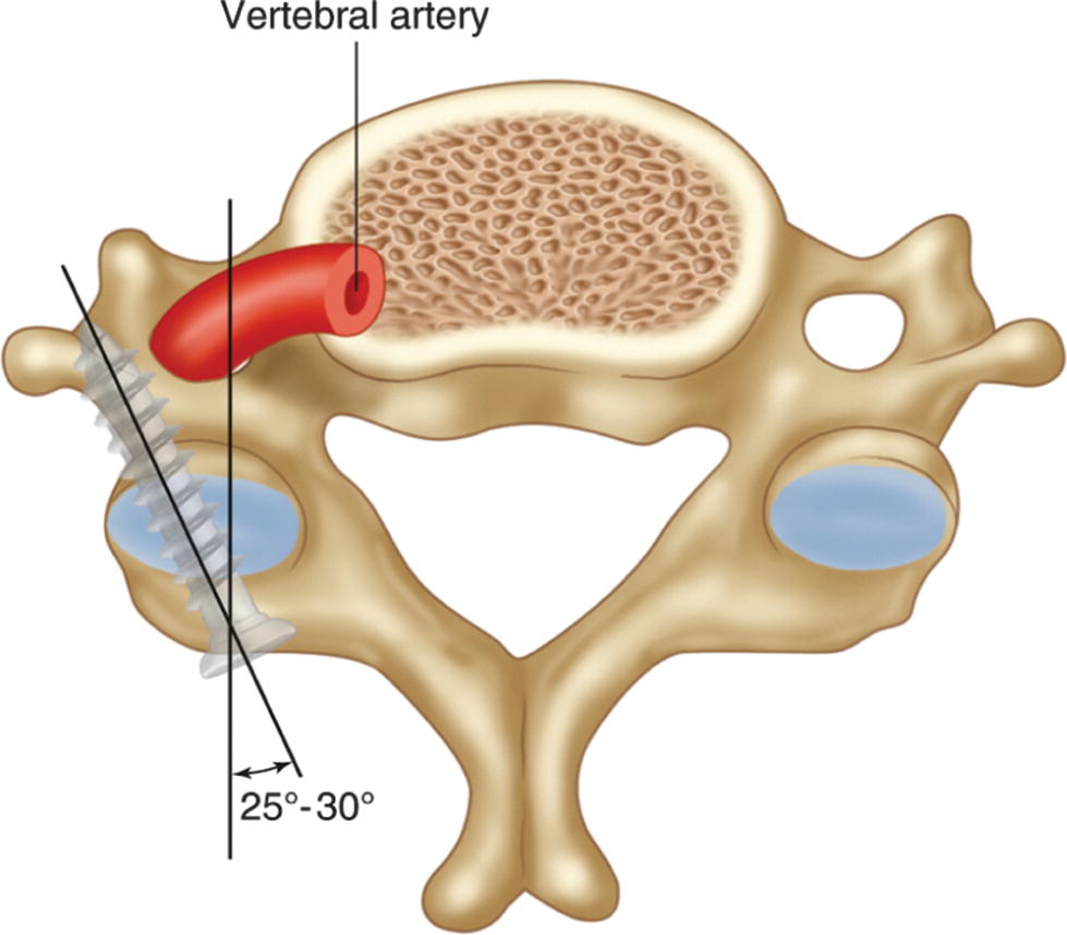 ../images/310119_2_En_12_Chapter/310119_2_En_12_Fig6_HTML.jpg