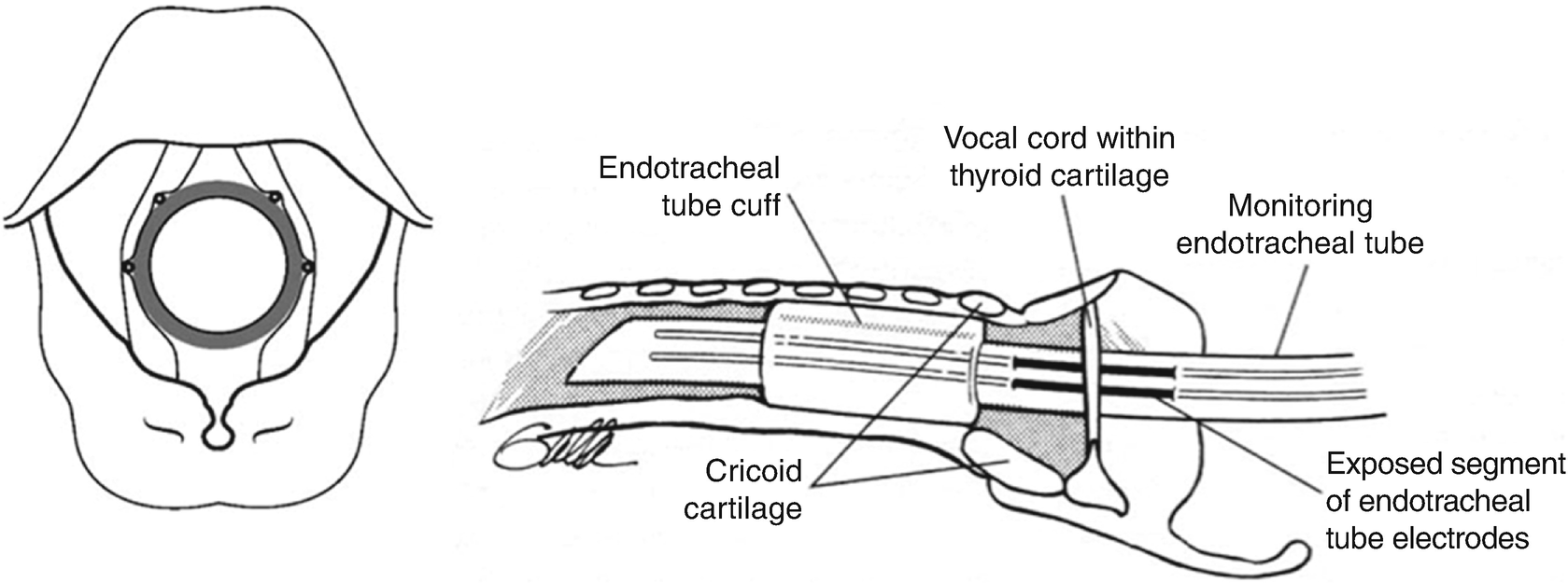 ../images/310119_2_En_16_Chapter/310119_2_En_16_Fig2_HTML.png