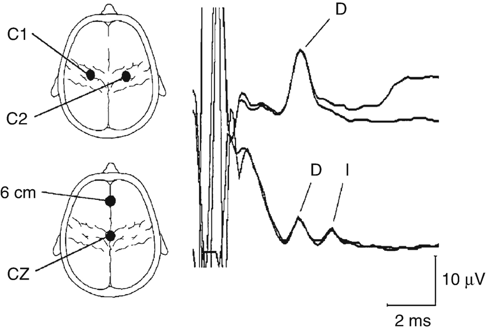 ../images/310119_2_En_7_Chapter/310119_2_En_7_Fig4_HTML.png