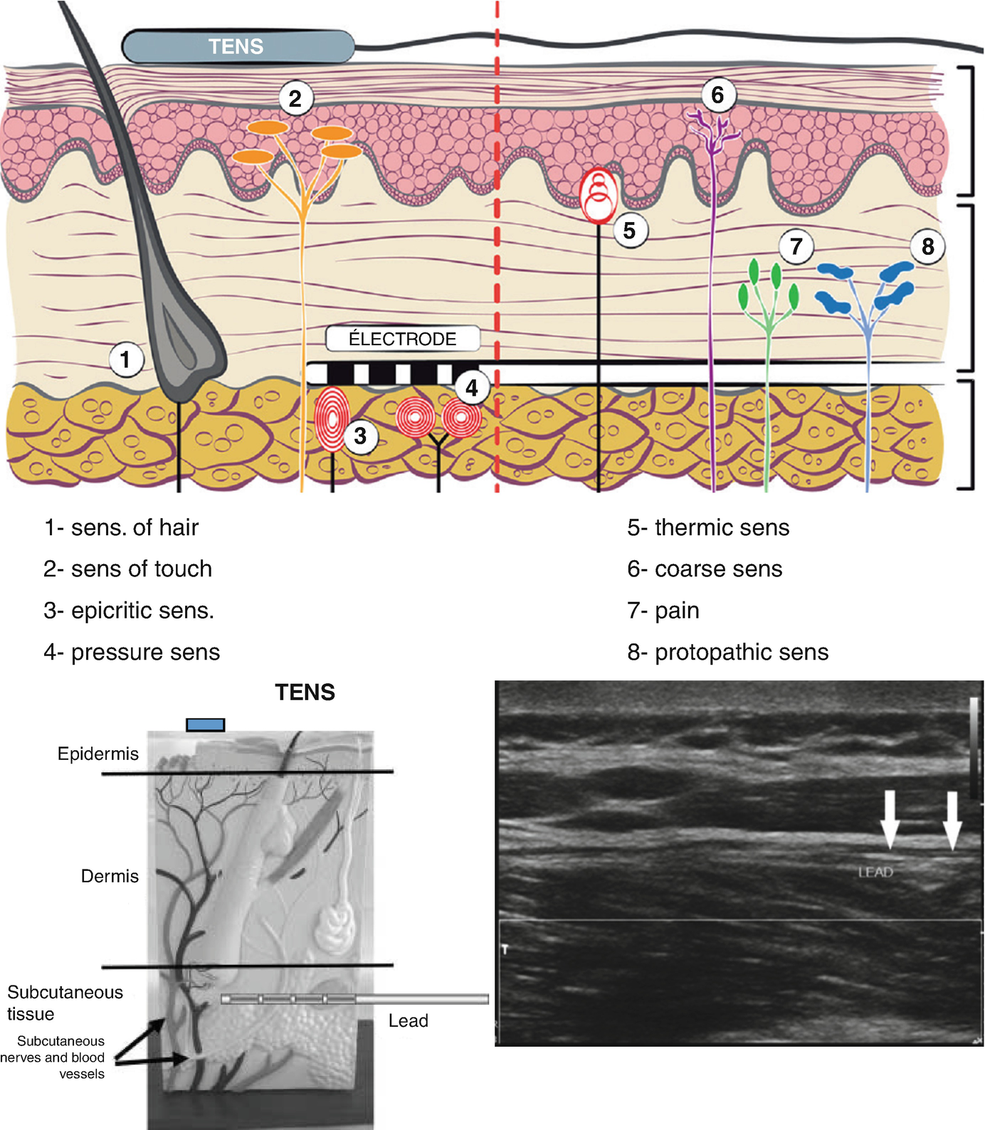 ../images/456566_1_En_15_Chapter/456566_1_En_15_Fig3_HTML.png