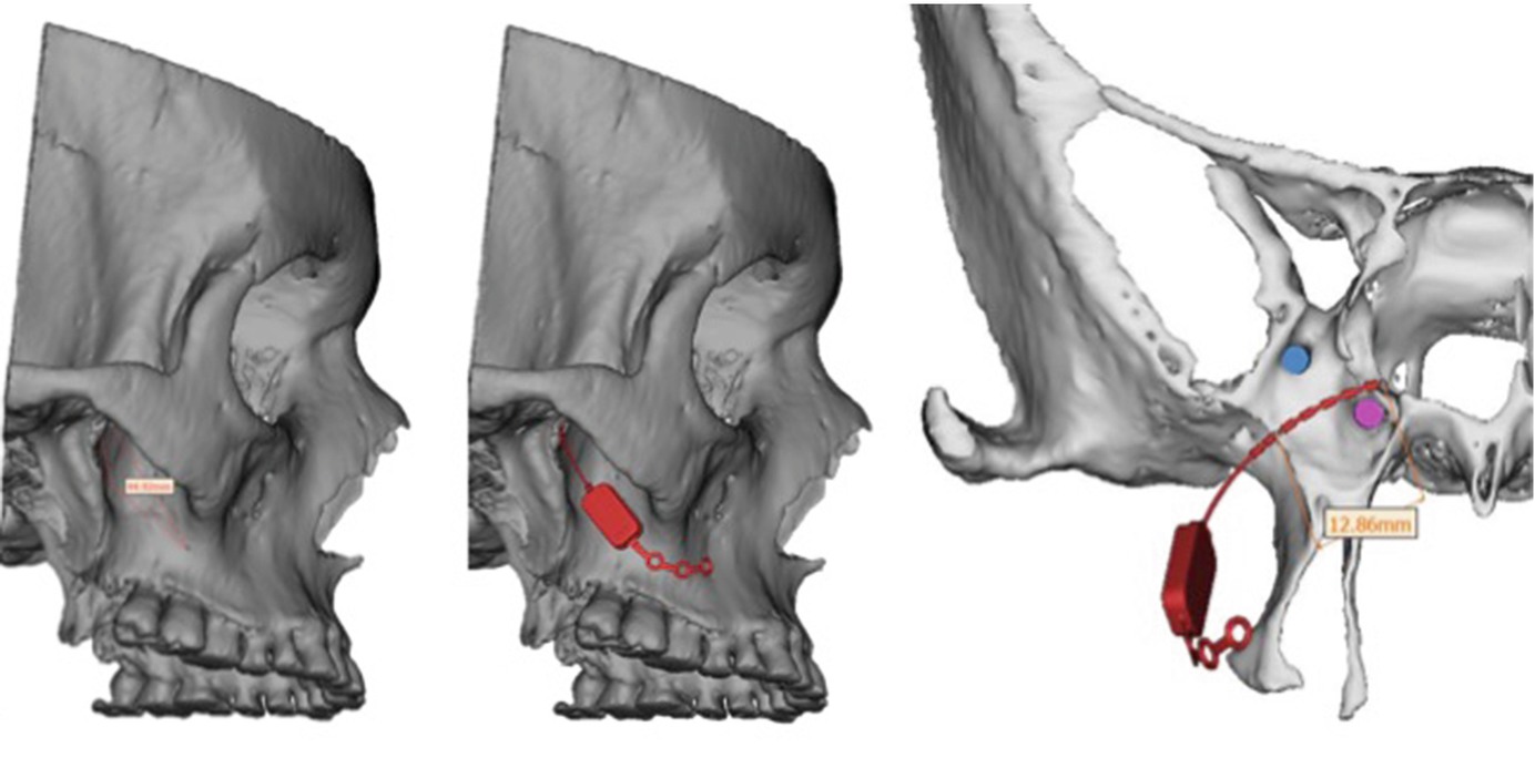 ../images/456566_1_En_5_Chapter/456566_1_En_5_Fig11_HTML.jpg