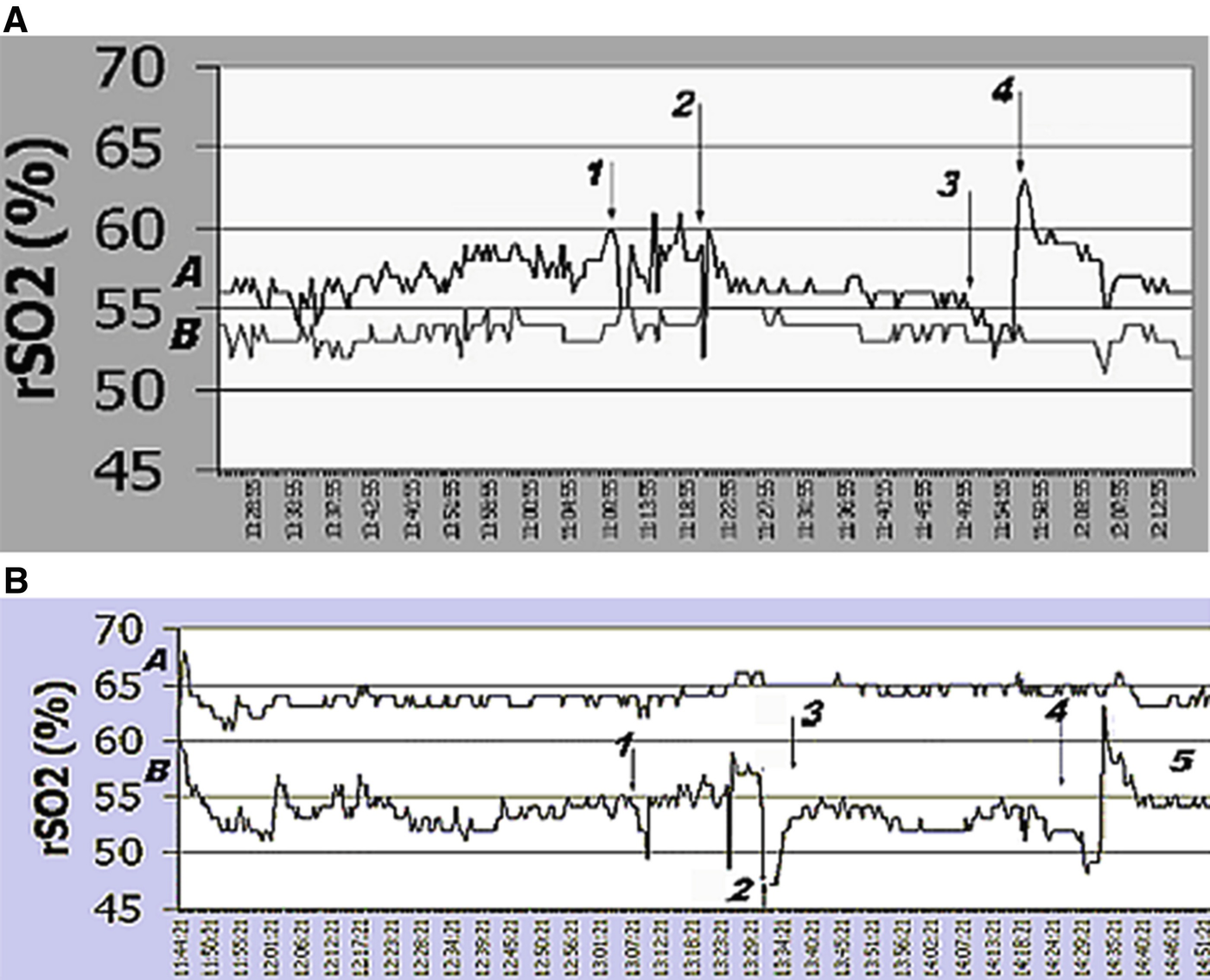 ../images/459789_1_En_17_Chapter/459789_1_En_17_Fig4_HTML.png