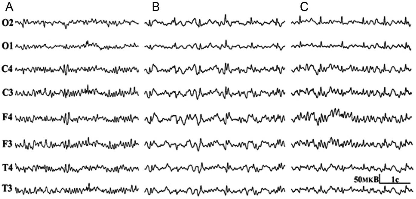 ../images/459789_1_En_17_Chapter/459789_1_En_17_Fig5_HTML.png