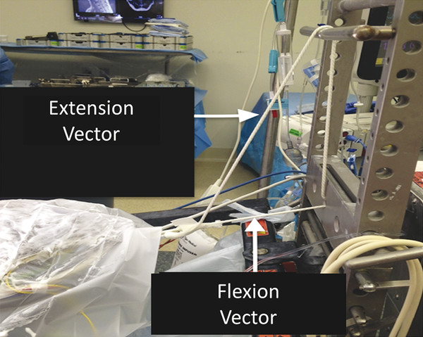 A photograph demonstrating the dual-vector traction setup with Jackson table.