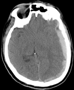 Neuroimaging (structural And Functional) | Neupsy Key