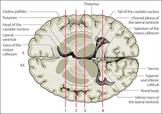 8 Basal Ganglia | Neupsy Key