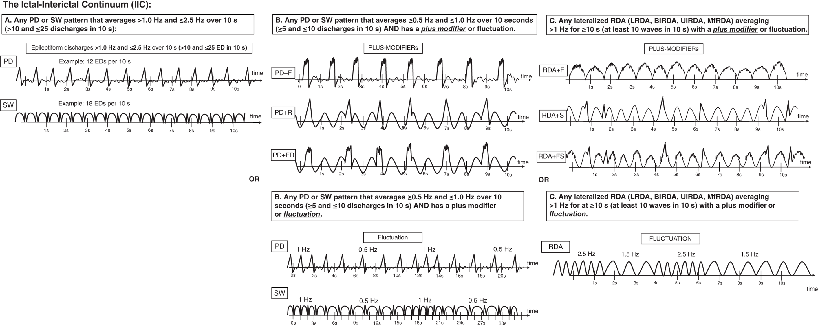 Schematic illustration of ictal-interictal continuum (IIC).