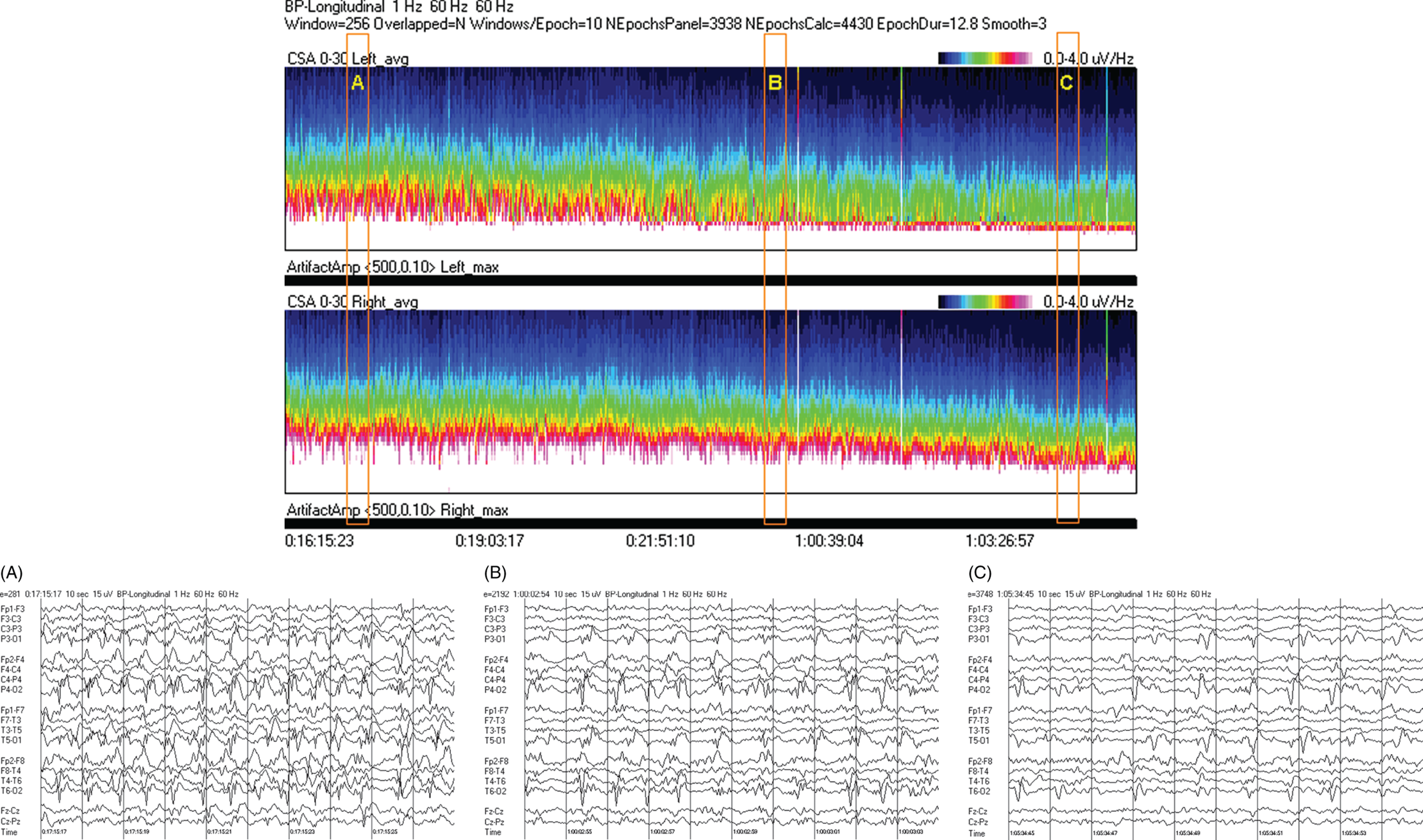 Schematic illustration of spectrogram basics, long-term trends: gradual resolution of ESE, IIC and BIPDs.