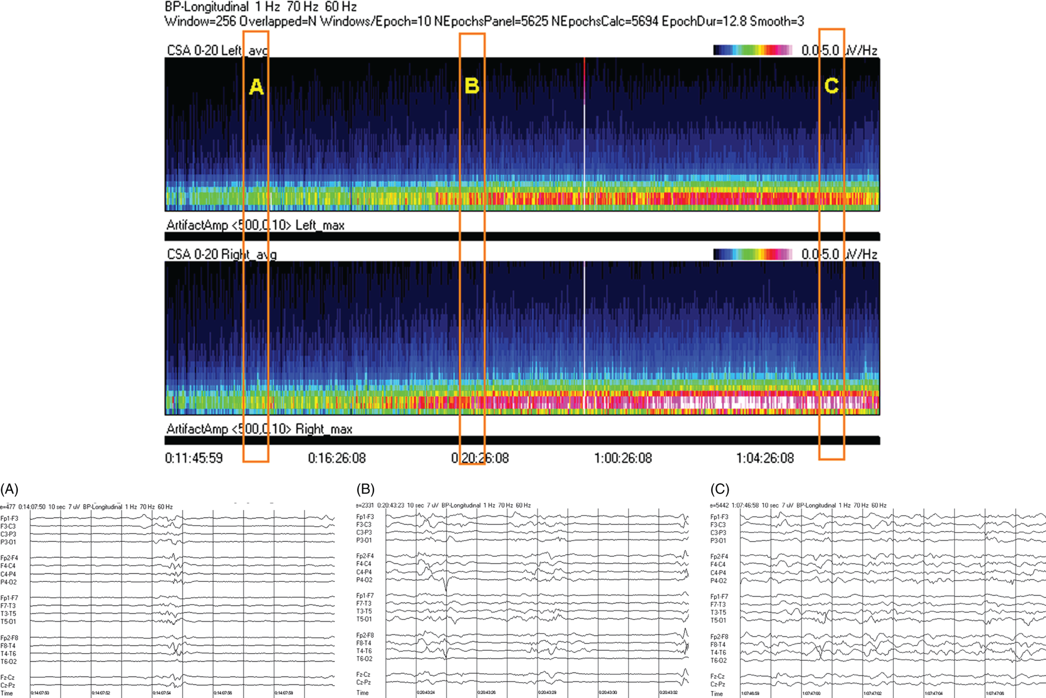 Schematic illustration of spectrogram basics, long-term trends: wearing off of pentobarbital.