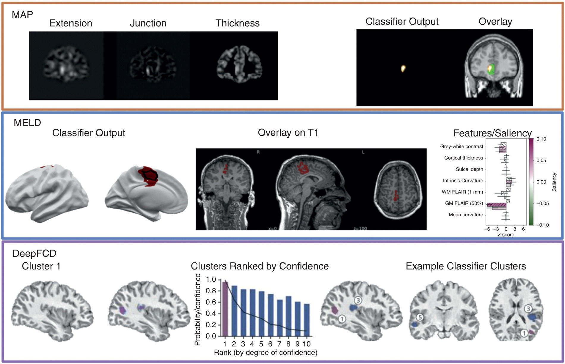 A three-part image depicts outputs from MAP, M E L D, and Deep F C D programs. It includes brain scans, graphs, and data visualizations related to focal cortical dysplasia.